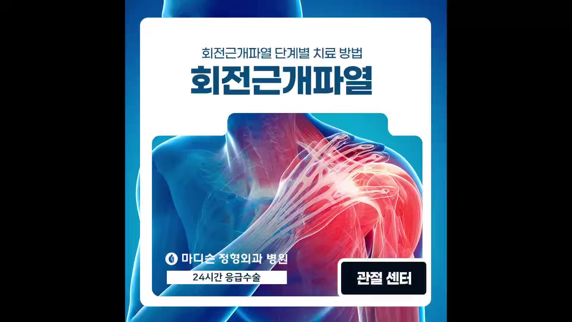 천안어깨병원 회전근개파열 단계별 치료 방법