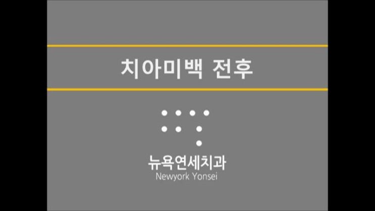  화이트닝 치아미백 ＃ 하얀치아만들기