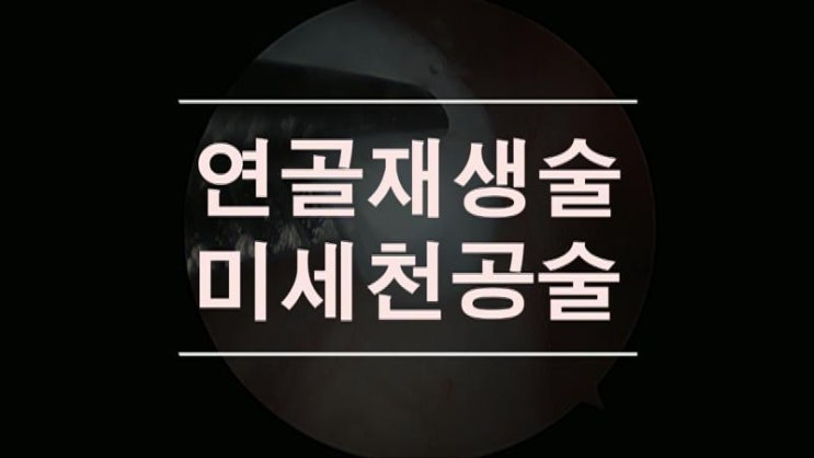  무릎연골재생 줄기세포 를 이용한 연골손상 치료방법