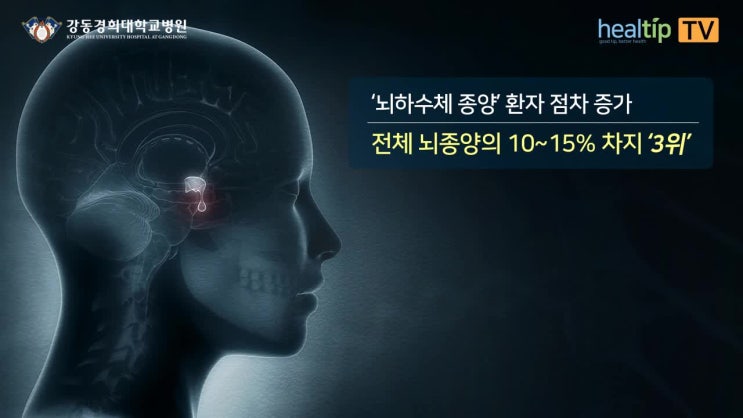 뇌종양 환자 3위 ‘뇌하수체 종양’ 주요 증상과 흉터 없는 내시경 치료 : 네이버 블로그
