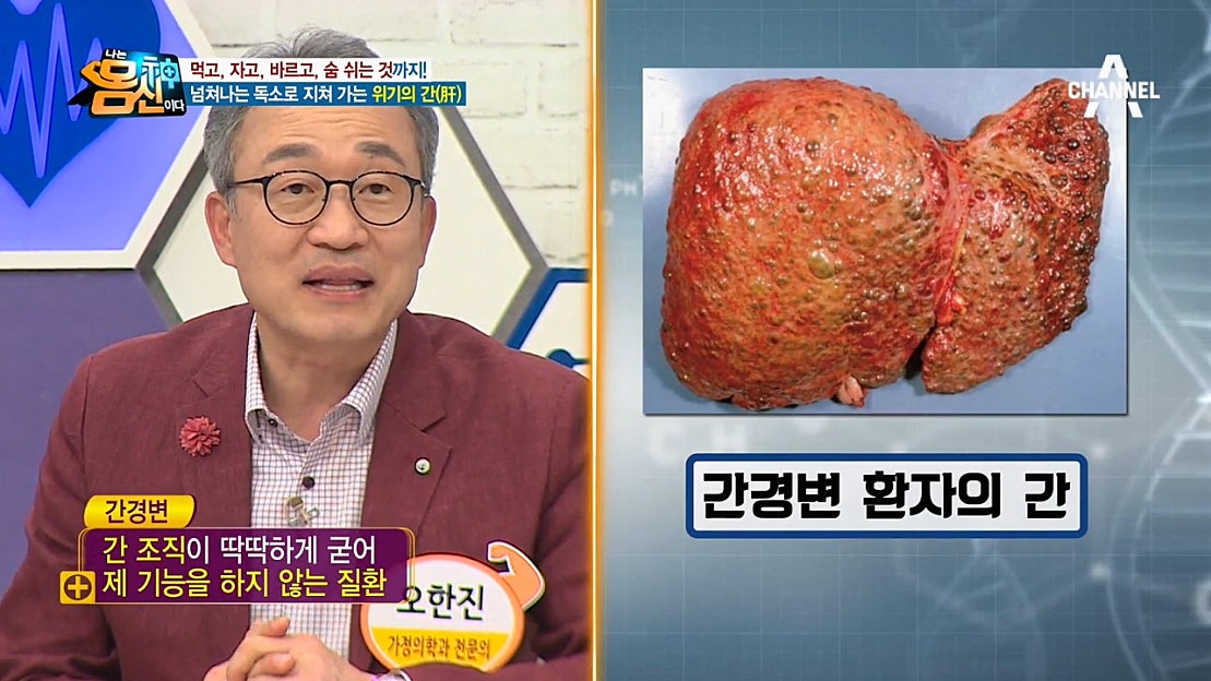 간(肝)이 건강해야 전신이 건강하다! 혈액 속 간 효소 수치 확인하기! - 네이버 TV