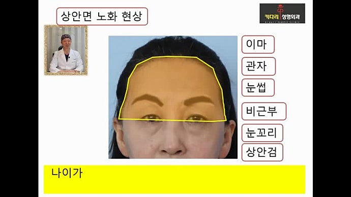 이마주름이 생기는 진짜 이유!! 자꾸 처지는 눈꺼풀, 눈썹도..??