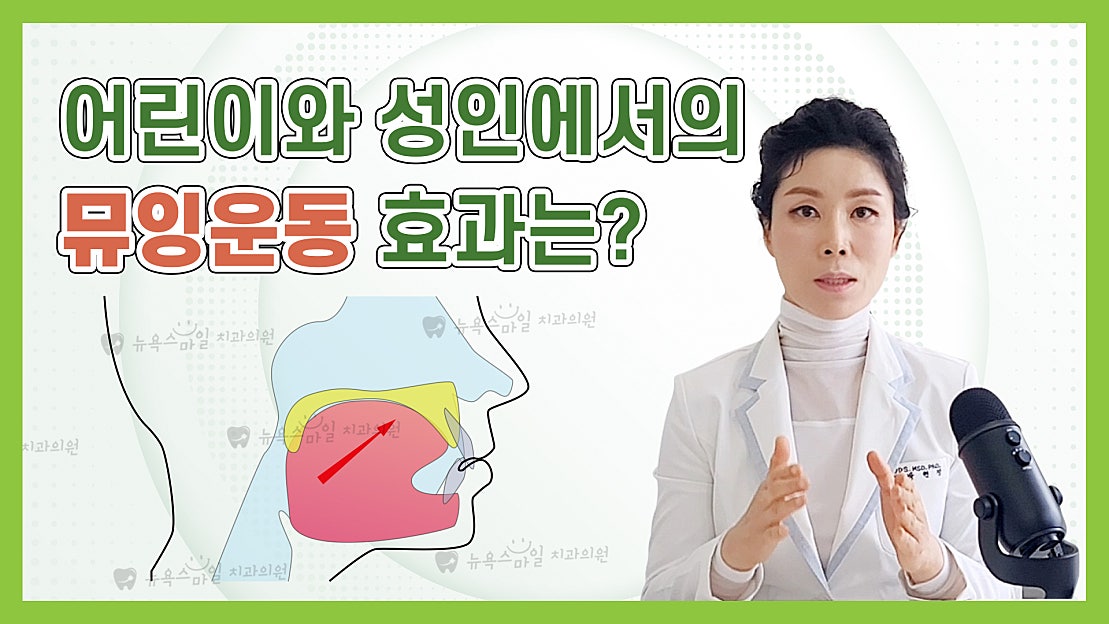 어린이와 성인에서의 뮤잉운동 효과는?? :: 3급부정교합,반대교합,주걱턱치아교정 - 네이버 TV