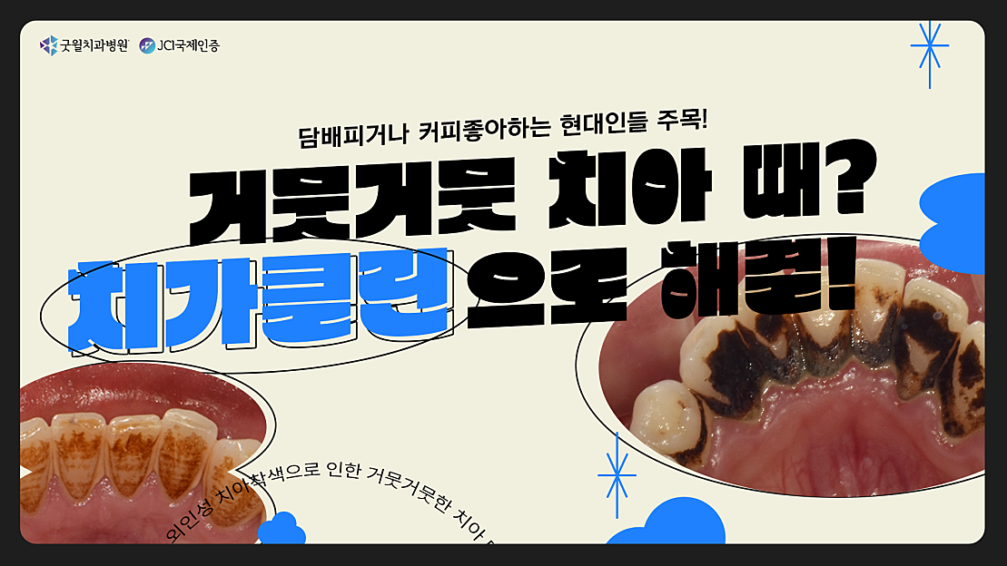 거뭇거뭇한 치아 때? 치아착색 해결은 치가클린으로 ! 🦷🔍 - 네이버 TV