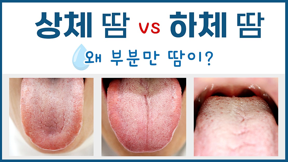 다한증/ 상체 땀 vs 하체 땀 원인 - 네이버 TV