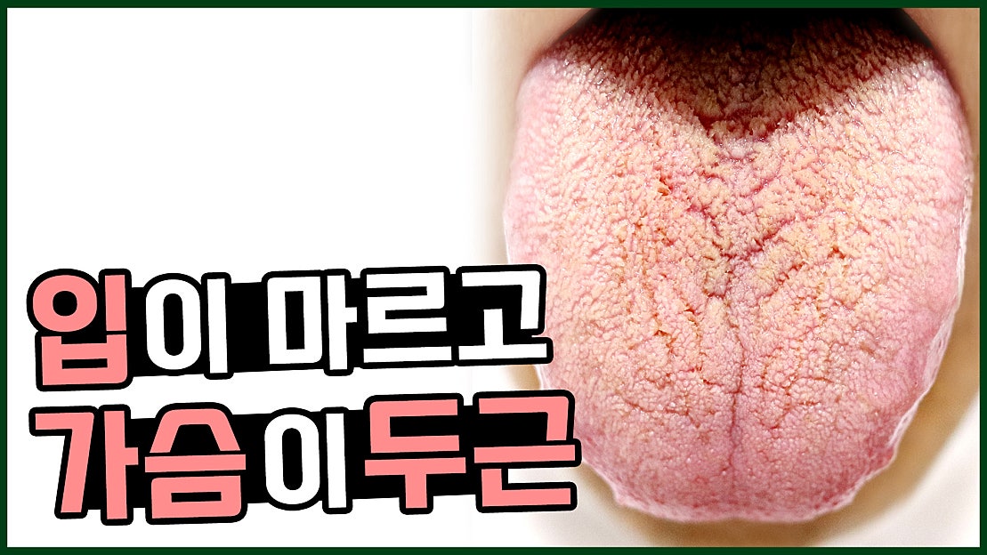 혀끝 구내염 설염/ 혀가 자꾸 헐어요. 혀에 염증이 생겨요. - 네이버 TV