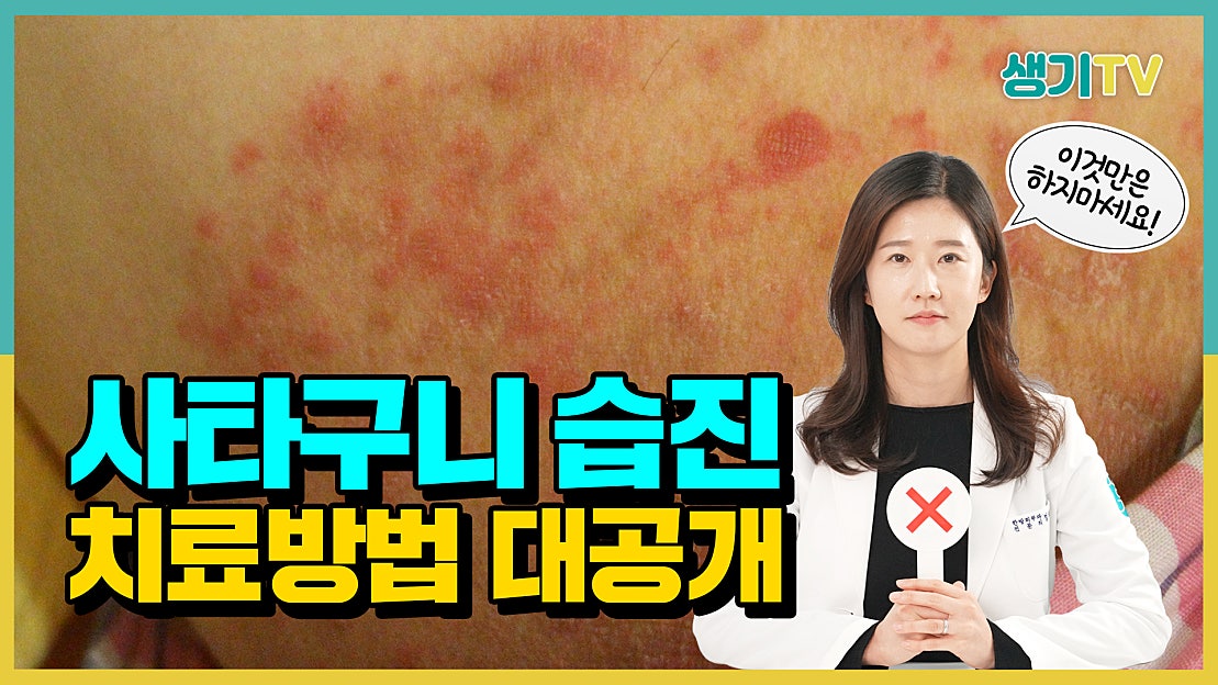 여름철 심해지는 사타구니 습진 생활 관리 방법 - 네이버 TV