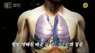 폐(肺)가망신의 공포 숨통을 사수하라!_인생의 연장전 60회 예고 TV CHOSUN 230913 방송