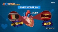 누가 내 혈관을 막고 있는가? 협심증과 심근경색 통증의 차이 MBN 230913 방송