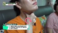 갑상선암 수술 후 면역력 올리는 건미인의 목 마사지🧘‍♀️ TV CHOSUN 230913 방송