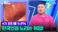 국내 한 해 평균 위암 환자 3만여 명 발생?! 한국인이 취약한 위암!