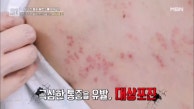 환절기, 주의해야할 질환은? MBN 230915 방송