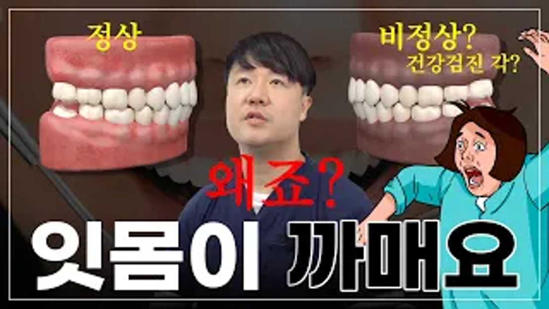 검은 까만 잇몸색이 되는 이유가 뭘까요? 몸이 안좋아서 생기는 문제인지? - 광주잇몸치료 - 네이버 TV