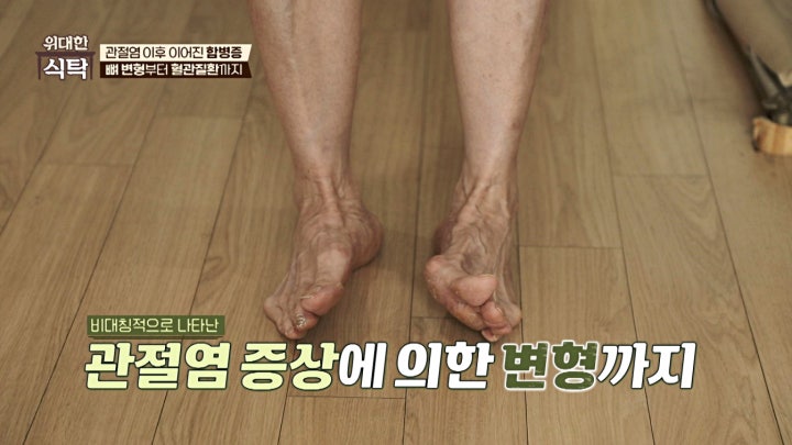 대수롭지 않았던 무릎 통증💥 방치하다 뼈 변형까지?! | JTBC 240217 방송