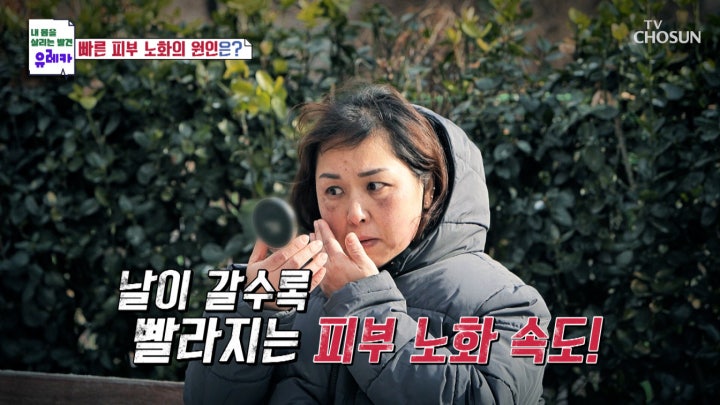 피부 노화 & 탈모가 발생되는 원인이 따로 있다?! TV CHOSUN 240218 방송