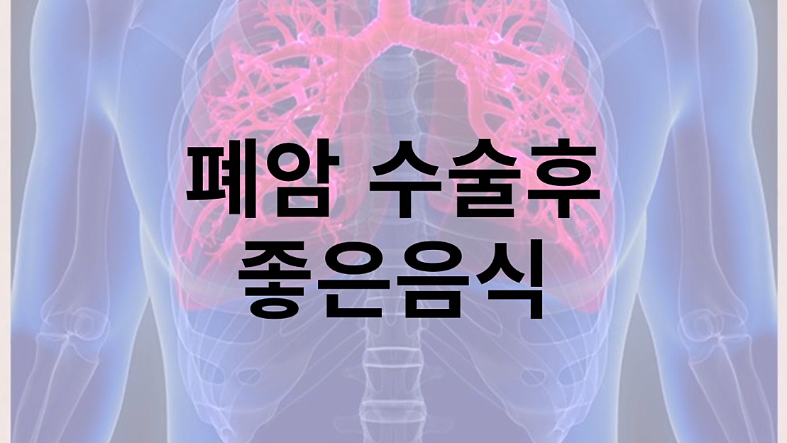 폐암 수술후 재발 전이 관리에 좋은음식 - 네이버 TV