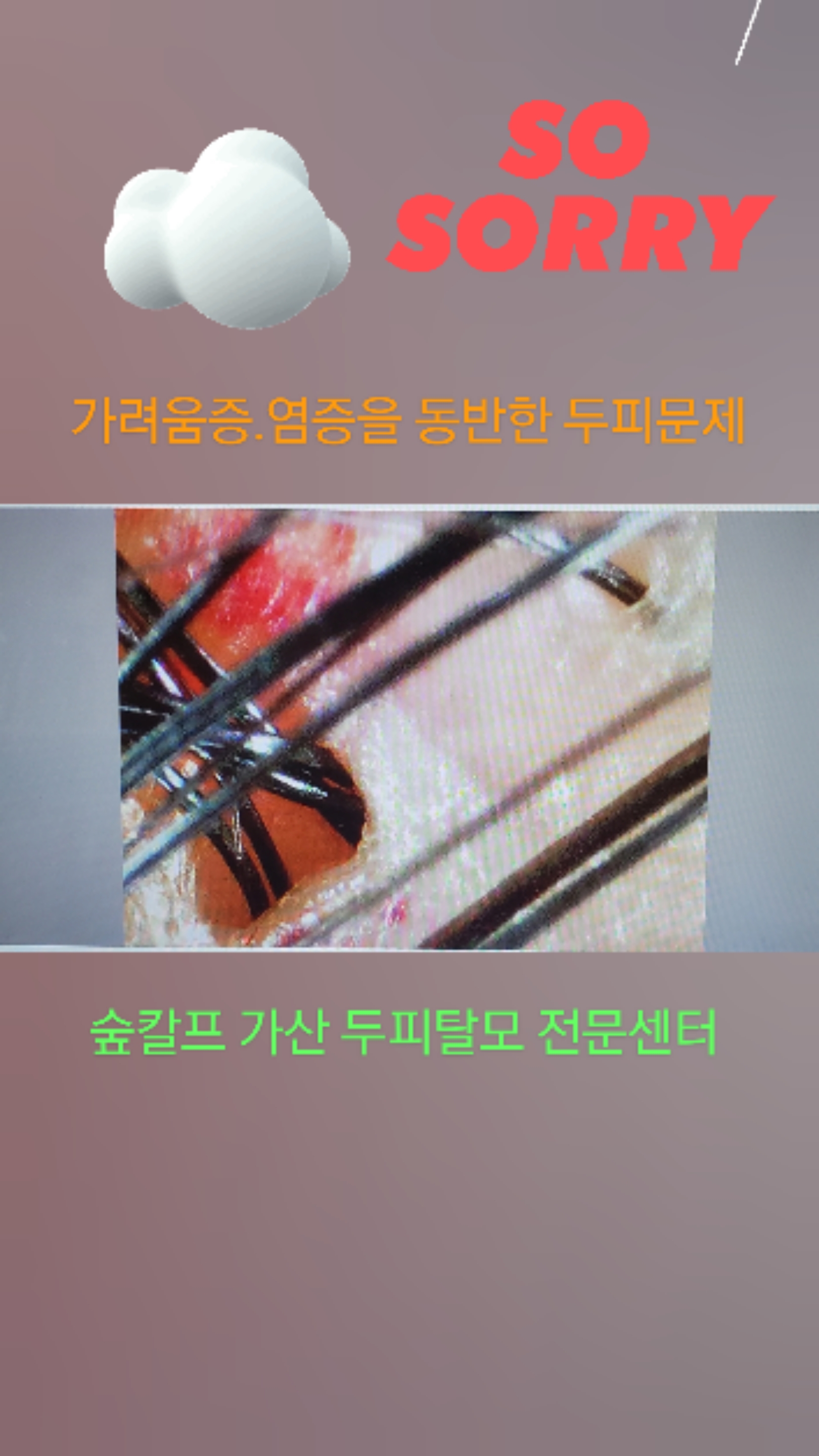 숲칼프가산두피탈모전문센터 이미지