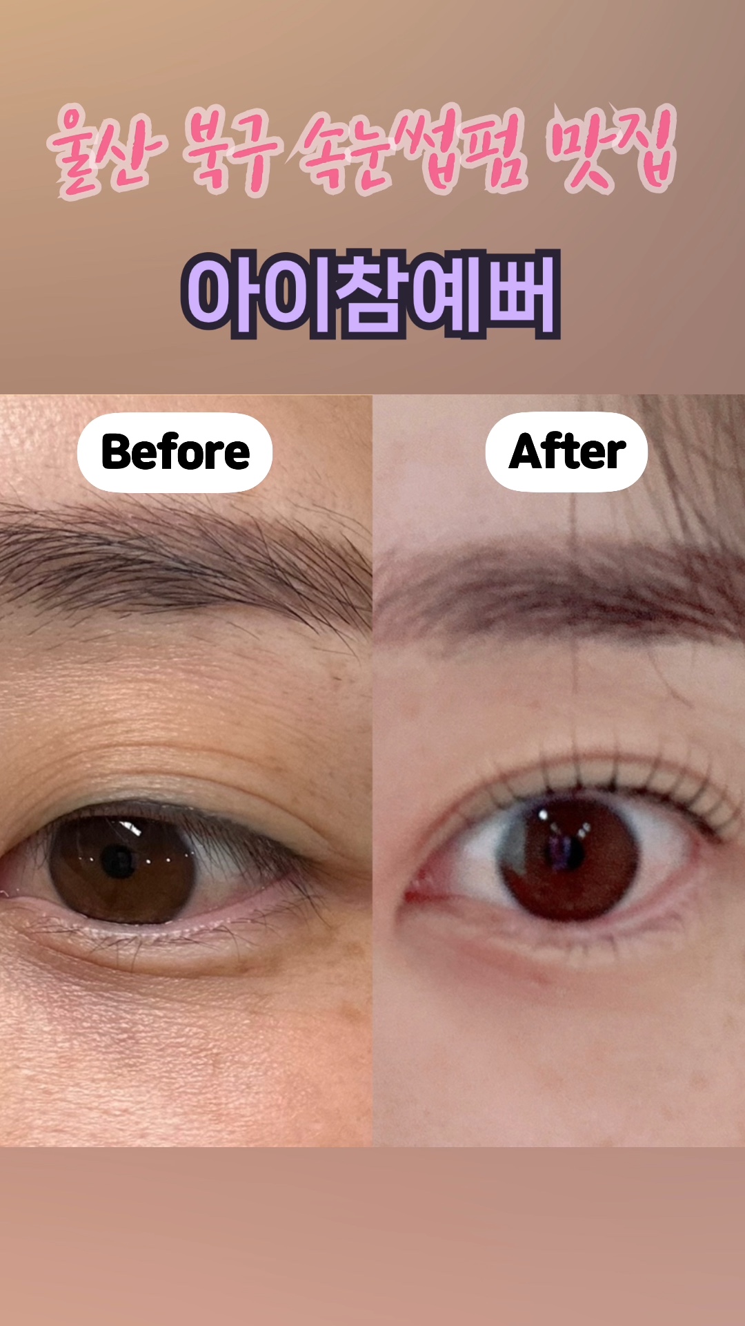 아이참예뻐 이미지
