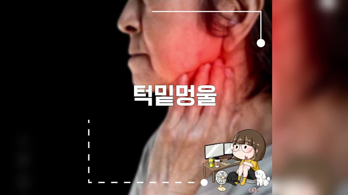 턱밑멍울 원인 - 네이버 TV
